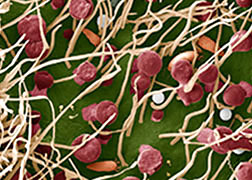 Description: A rose mite hides deep within a rose. 