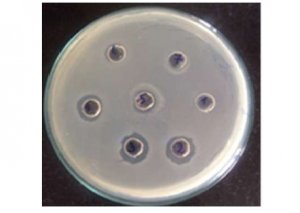 Tạo d&ograve;ng v&agrave; biểu hiện enzyme endolysin t&aacute;i tổ hợp trong Escherichia coli từ staphylococcal bacteriophages NA6