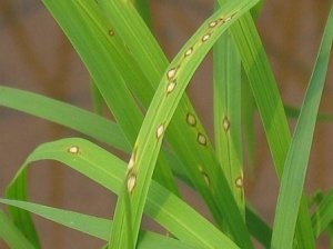 Đột ph&aacute; trong cuộc chiến chống lại bệnh đạo &ocirc;n