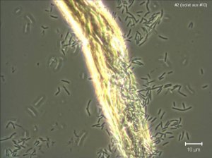 Ph&aacute;t hiện một loại vi khuẩn ăn được cả kh&iacute; CO2, liệu c&oacute; thể giải quyết được hiện tượng biến đổi kh&iacute; hậu to&agrave;n cầu?
