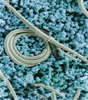Trứng của c&aacute;c đ&agrave;n gia cầm quy m&ocirc; nhỏ c&oacute; khả năng chứa Salmonella enteritidis