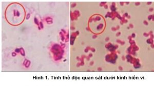 X&aacute;c định gen Vip3A trong vi khuẩn Bacillus thuringiensis var. kurstaki bằng kỹ thuật sinh học ph&acirc;n tử v&agrave; độc t&iacute;nh g&acirc;y bệnh đối với c&ocirc;n tr&ugrave;ng g&acirc;y hại